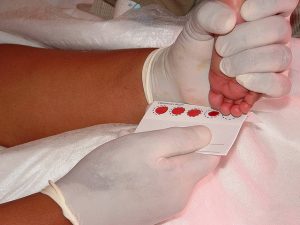 Prick-Allergietest für Kleikinder beim Arzt